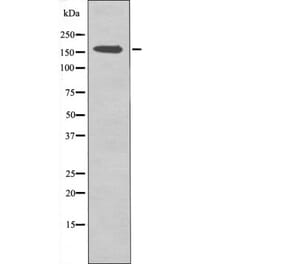 Western blot - CFTR (Phospho-Ser737) Antibody from Signalway Antibody (12427) - Antibodies.com