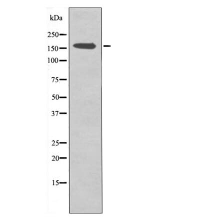 Western blot - CFTR (Phospho-Ser737) Antibody from Signalway Antibody (12427) - Antibodies.com