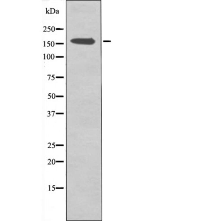 Western blot - CFTR (Phospho-Ser737) Antibody from Signalway Antibody (12427) - Antibodies.com