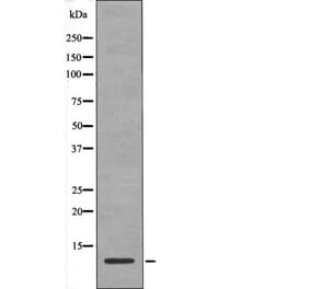 Western blot - HMG17 (Phospho-Ser29) Antibody from Signalway Antibody (12442) - Antibodies.com