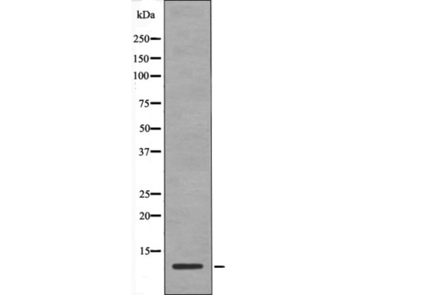 Western blot - HMG17 (Phospho-Ser29) Antibody from Signalway Antibody (12442) - Antibodies.com
