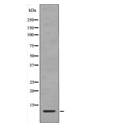 Western blot - HMG17 (Phospho-Ser29) Antibody from Signalway Antibody (12442) - Antibodies.com
