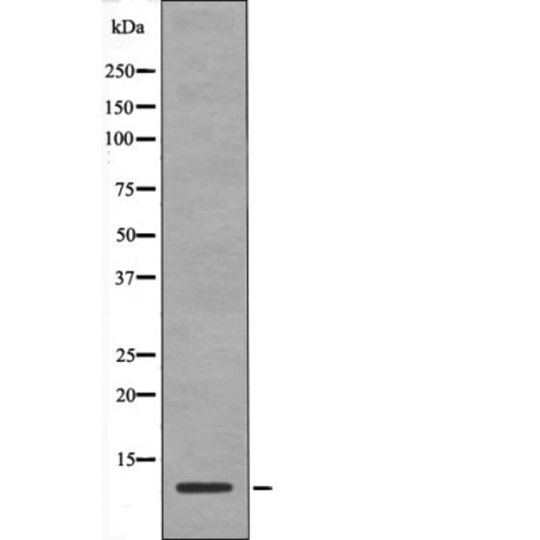 Western blot - HMG17 (Phospho-Ser29) Antibody from Signalway Antibody (12442) - Antibodies.com