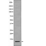 Western blot - HMG17 (Phospho-Ser29) Antibody from Signalway Antibody (12442) - Antibodies.com