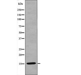 Western blot - VAMP4 (Phospho-Ser30) Antibody from Signalway Antibody (12462) - Antibodies.com