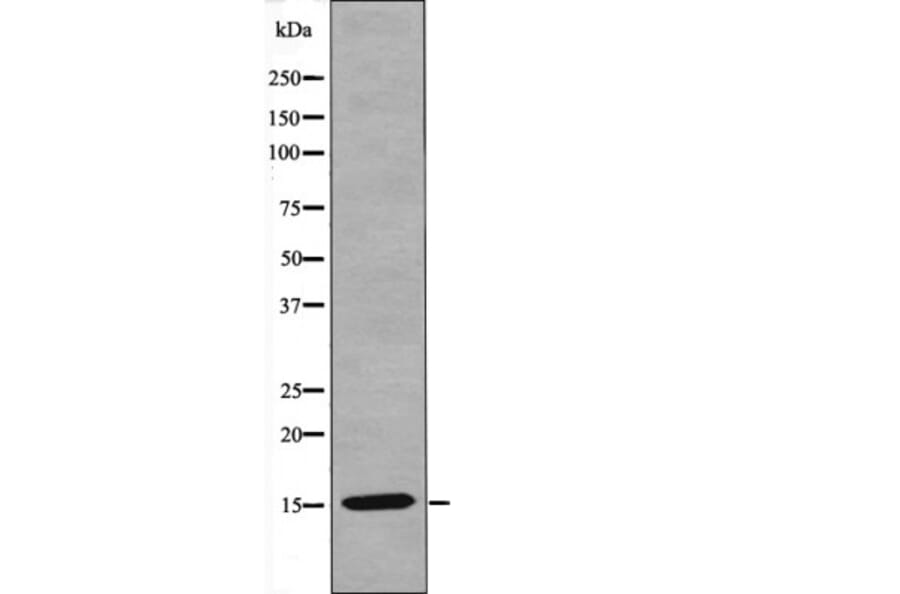 Western blot - VAMP4 (Phospho-Ser30) Antibody from Signalway Antibody (12462) - Antibodies.com