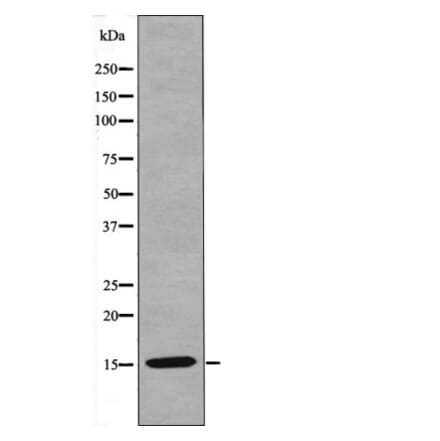 Western blot - VAMP4 (Phospho-Ser30) Antibody from Signalway Antibody (12462) - Antibodies.com