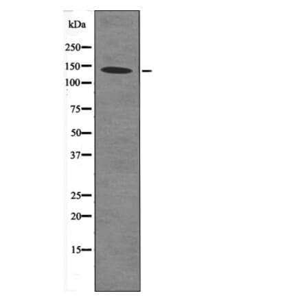 Western blot - eNOS (Phospho-Ser633) Antibody from Signalway Antibody (12473) - Antibodies.com