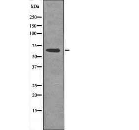 Western blot - AFX1 (Phospho-Thr455) Antibody from Signalway Antibody (12477) - Antibodies.com
