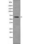 Western blot - AFX1 (Phospho-Thr455) Antibody from Signalway Antibody (12477) - Antibodies.com