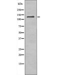Western blot - JAK3 (Phospho-Tyr981) Antibody from Signalway Antibody (12512) - Antibodies.com