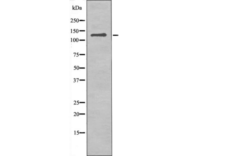 Western blot - JAK3 (Phospho-Tyr981) Antibody from Signalway Antibody (12512) - Antibodies.com