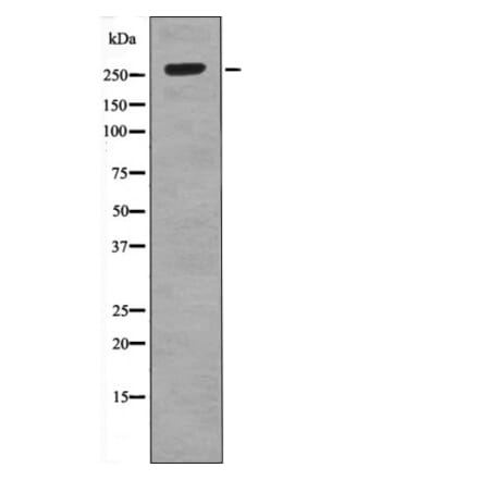 Western blot - ROS (Phospho-Tyr2274) Antibody from Signalway Antibody (12531) - Antibodies.com
