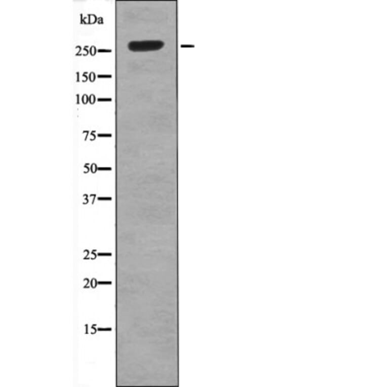 Western blot - ROS (Phospho-Tyr2274) Antibody from Signalway Antibody (12531) - Antibodies.com