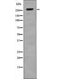 Western blot - ROS (Phospho-Tyr2274) Antibody from Signalway Antibody (12531) - Antibodies.com