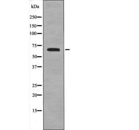 Western blot - FRS2 (Phospho-Tyr196) Antibody from Signalway Antibody (12539) - Antibodies.com