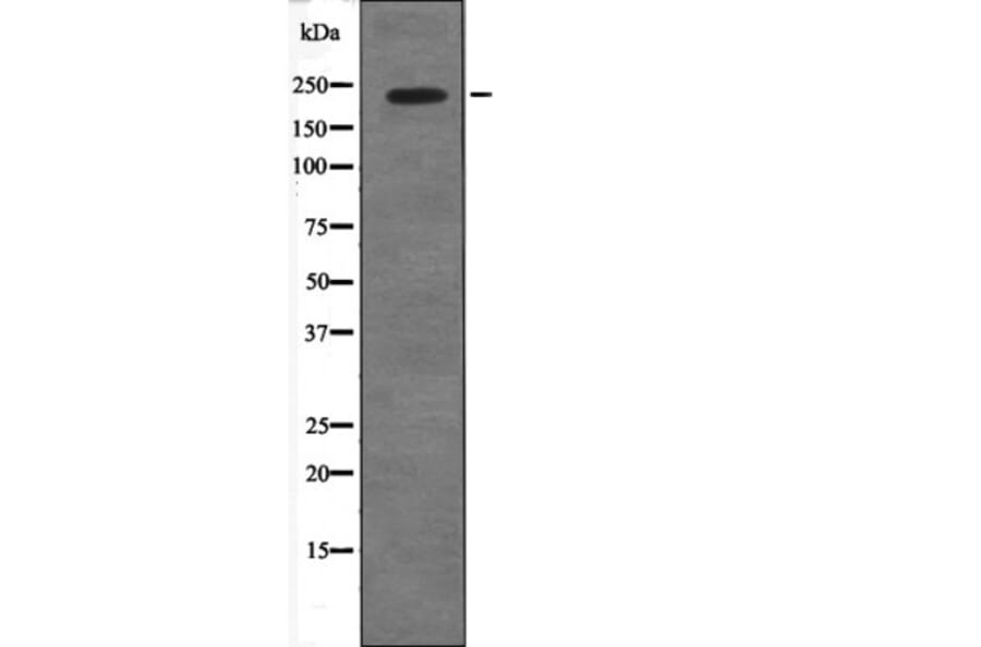 Western blot - 53BP1 (Phospho-Ser29) Antibody from Signalway Antibody (12569) - Antibodies.com