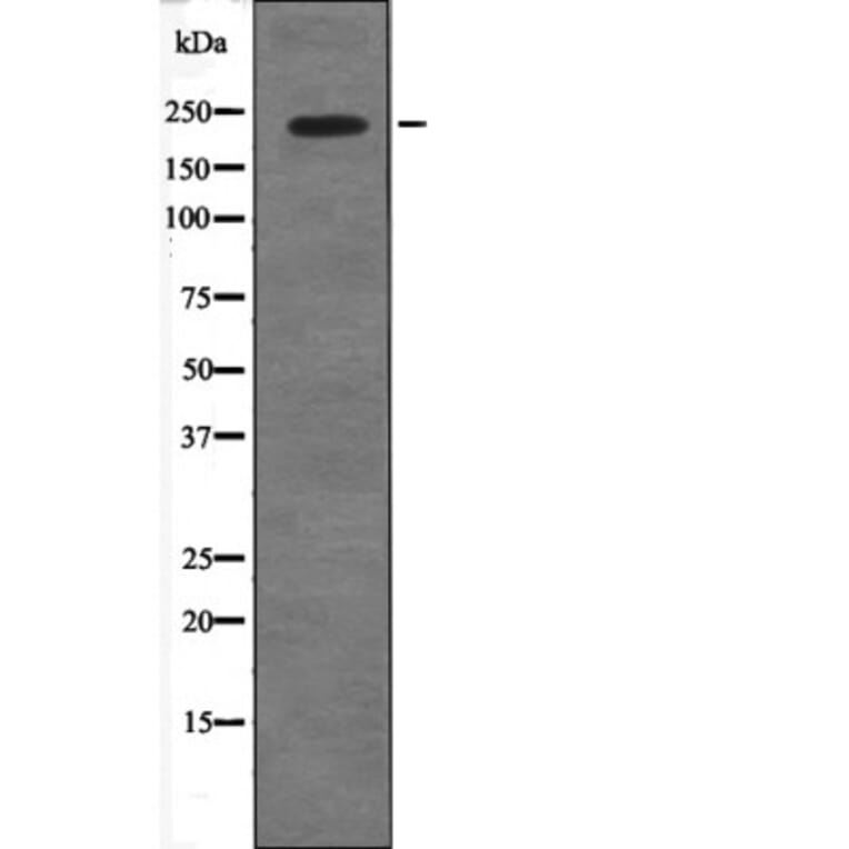 Western blot - 53BP1 (Phospho-Ser29) Antibody from Signalway Antibody (12569) - Antibodies.com