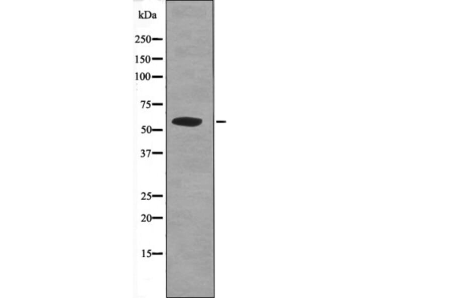 Western blot - APLF (Phospho-Ser116) Antibody from Signalway Antibody (12573) - Antibodies.com