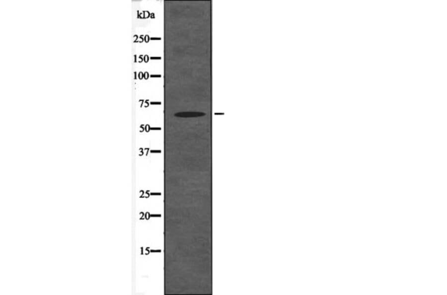 Western blot - BAG3 (Phospho-Tyr457) Antibody from Signalway Antibody (12575) - Antibodies.com