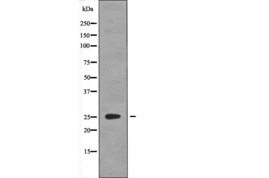 Western blot - GAIP (Phospho-Ser151) Antibody from Signalway Antibody (12603) - Antibodies.com