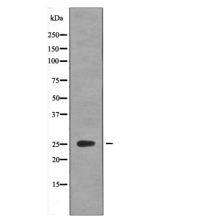 Western blot - GAIP (Phospho-Ser151) Antibody from Signalway Antibody (12603) - Antibodies.com