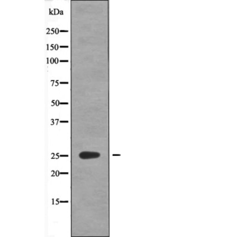 Western blot - GAIP (Phospho-Ser151) Antibody from Signalway Antibody (12603) - Antibodies.com