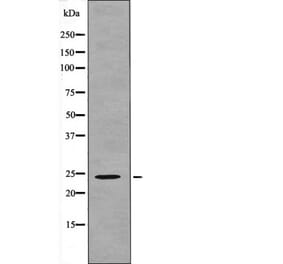 Western blot - NACA (Phospho-Thr159) Antibody from Signalway Antibody (12618) - Antibodies.com