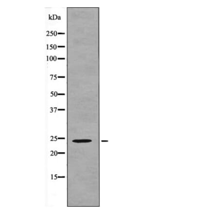 Western blot - NACA (Phospho-Thr159) Antibody from Signalway Antibody (12618) - Antibodies.com