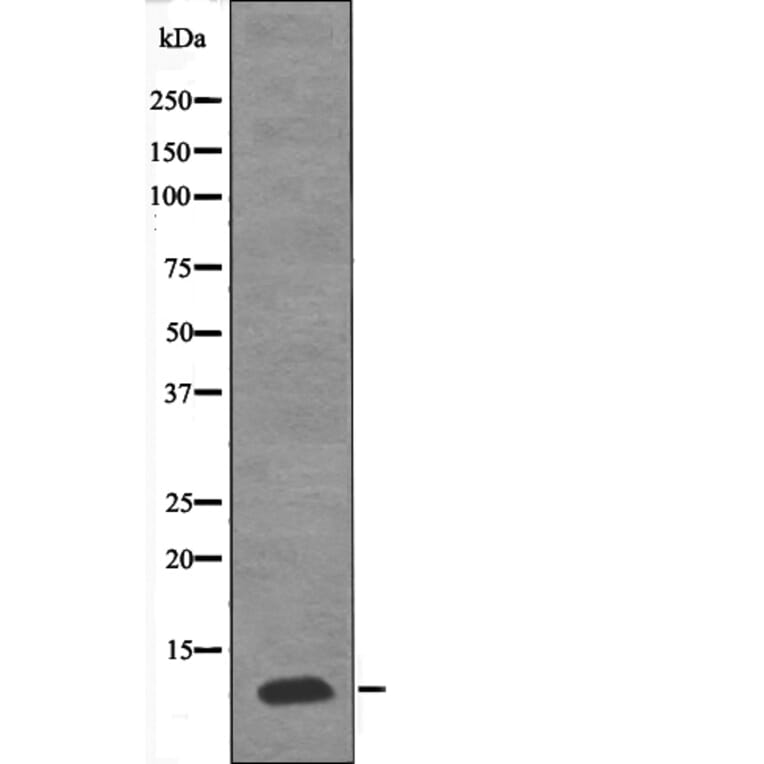 Western blot - PDE6G (Phospho-Thr22) Antibody from Signalway Antibody (12624) - Antibodies.com