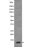 Western blot - PDE6G (Phospho-Thr22) Antibody from Signalway Antibody (12624) - Antibodies.com