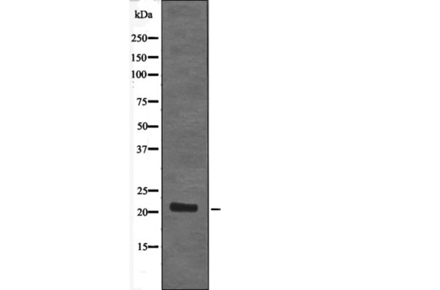 Western blot - STMN2 (Phospho-Ser73) Antibody from Signalway Antibody (12644) - Antibodies.com