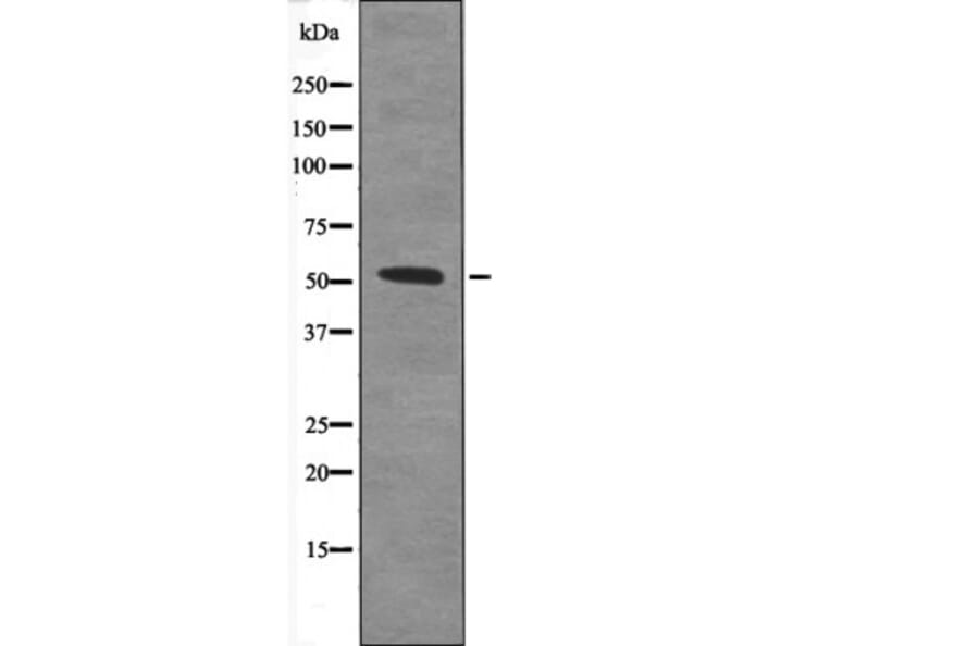 Western blot - TAB1 (Phospho-Ser438) Antibody from Signalway Antibody (12645) - Antibodies.com