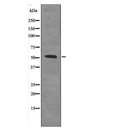 Western blot - TAB1 (Phospho-Ser438) Antibody from Signalway Antibody (12645) - Antibodies.com