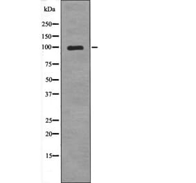Western blot - TLR5 (Phospho-Tyr798) Antibody from Signalway Antibody (12648) - Antibodies.com
