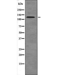 Western blot - USP28 (Phospho-Ser67) Antibody from Signalway Antibody (12652) - Antibodies.com