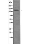 Western blot - USP28 (Phospho-Ser67) Antibody from Signalway Antibody (12652) - Antibodies.com