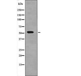 Western blot - SGK1 (Phospho-Thr256) Antibody from Signalway Antibody (12667) - Antibodies.com