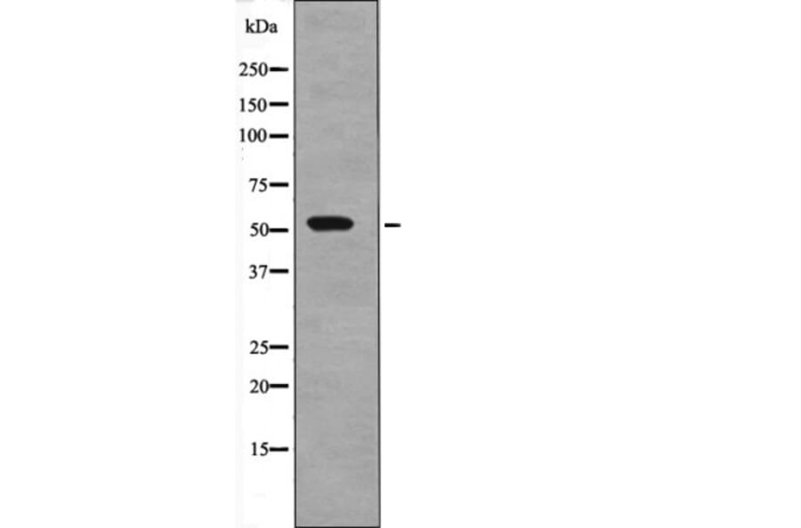 Western blot - SGK1 (Phospho-Thr256) Antibody from Signalway Antibody (12667) - Antibodies.com