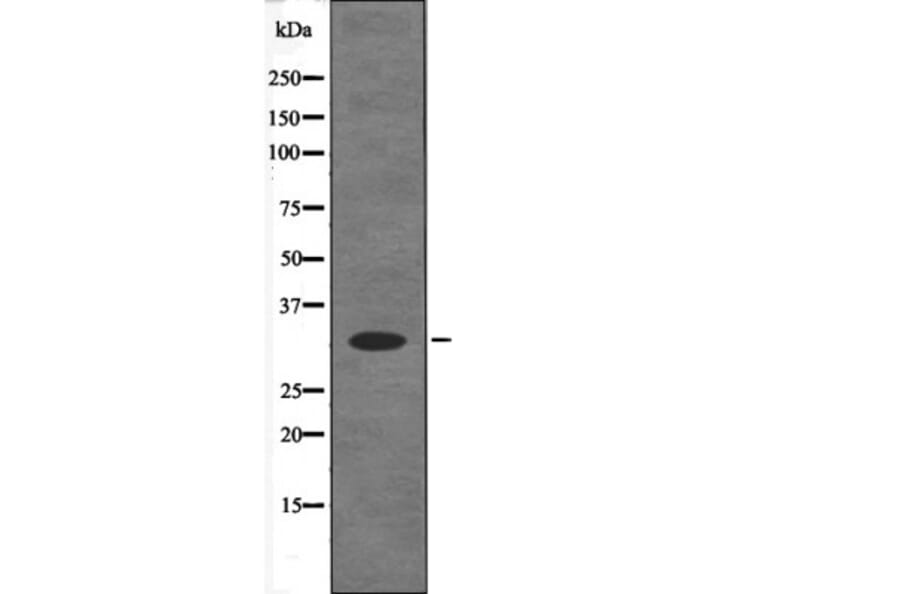 Western blot - CDK5 (Phospho-Ser159) Antibody from Signalway Antibody (12677) - Antibodies.com