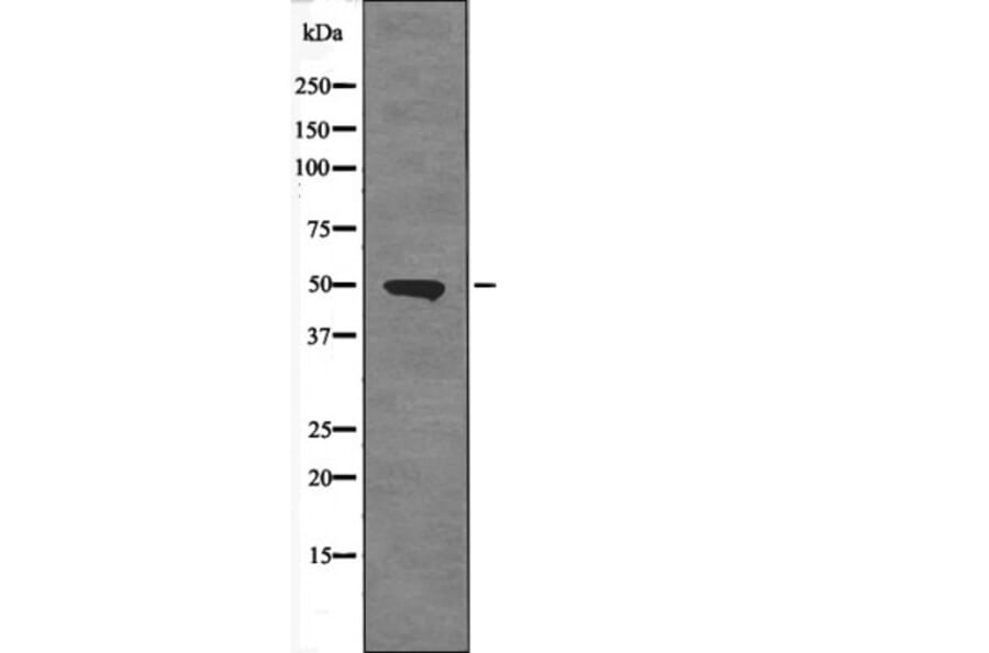 Western blot - ETS1 (Phospho-Ser251) Antibody from Signalway Antibody (12680) - Antibodies.com