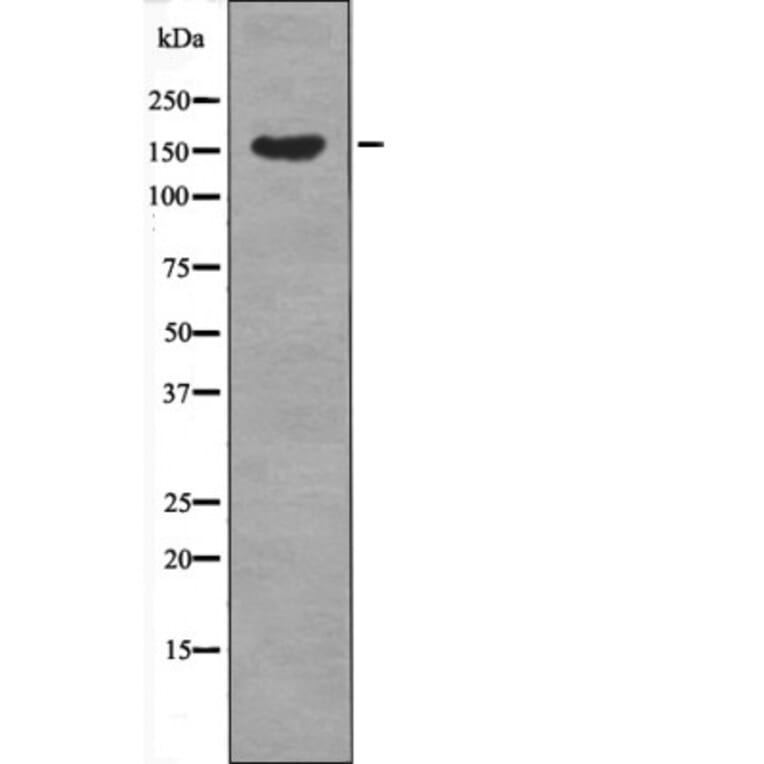Western blot - MET (Phospho-Tyr1365) Antibody from Signalway Antibody (12690) - Antibodies.com