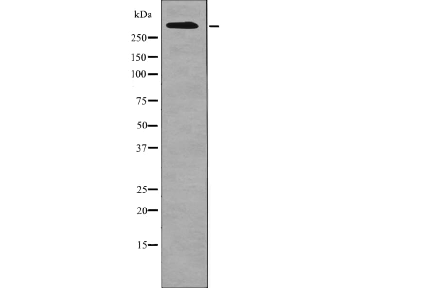 Western blot - ATM (Phospho-Ser1987) Antibody from Signalway Antibody (12701) - Antibodies.com