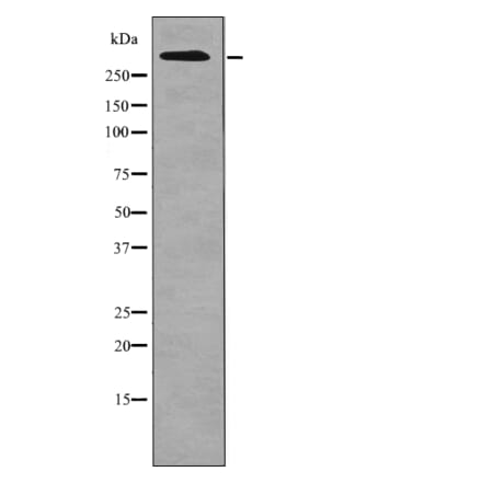 Western blot - ATM (Phospho-Ser1987) Antibody from Signalway Antibody (12701) - Antibodies.com
