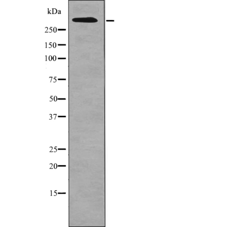 Western blot - ATM (Phospho-Ser1987) Antibody from Signalway Antibody (12701) - Antibodies.com