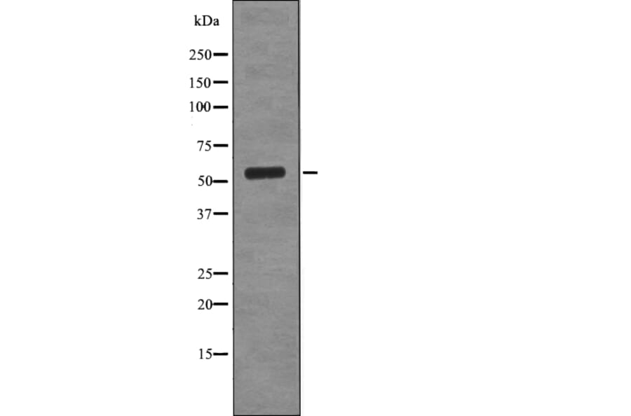 Western blot - CD66 (Phospho-Ser508) Antibody from Signalway Antibody (12703) - Antibodies.com