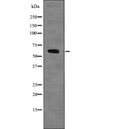 Western blot - Chk2 (Phospho-Ser379) Antibody from Signalway Antibody (12704) - Antibodies.com