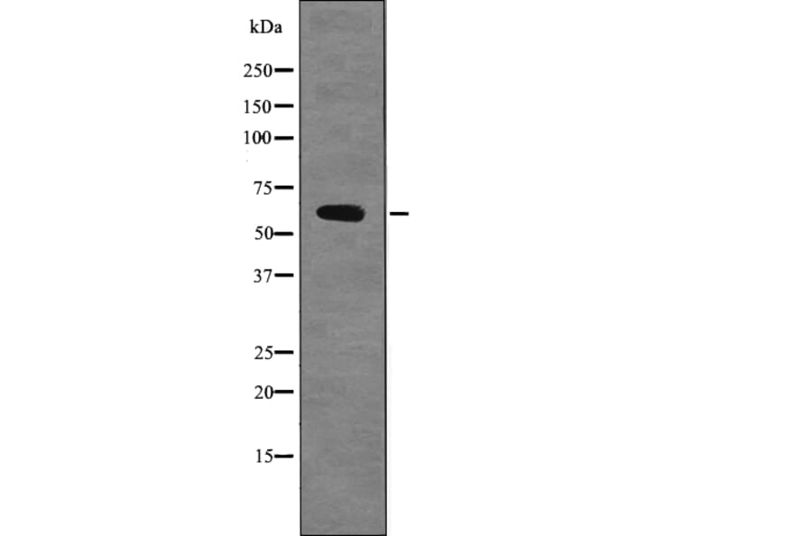 Western blot - Chk2 (Phospho-Ser379) Antibody from Signalway Antibody (12704) - Antibodies.com