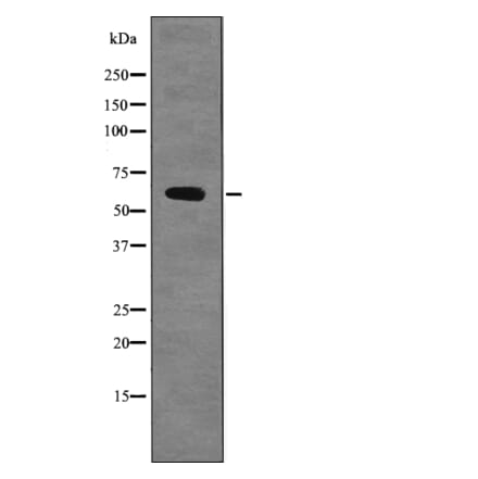 Western blot - Chk2 (Phospho-Ser379) Antibody from Signalway Antibody (12704) - Antibodies.com