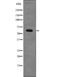 Western blot - Chk2 (Phospho-Ser379) Antibody from Signalway Antibody (12704) - Antibodies.com